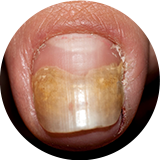 �չ��� ���� �� ����